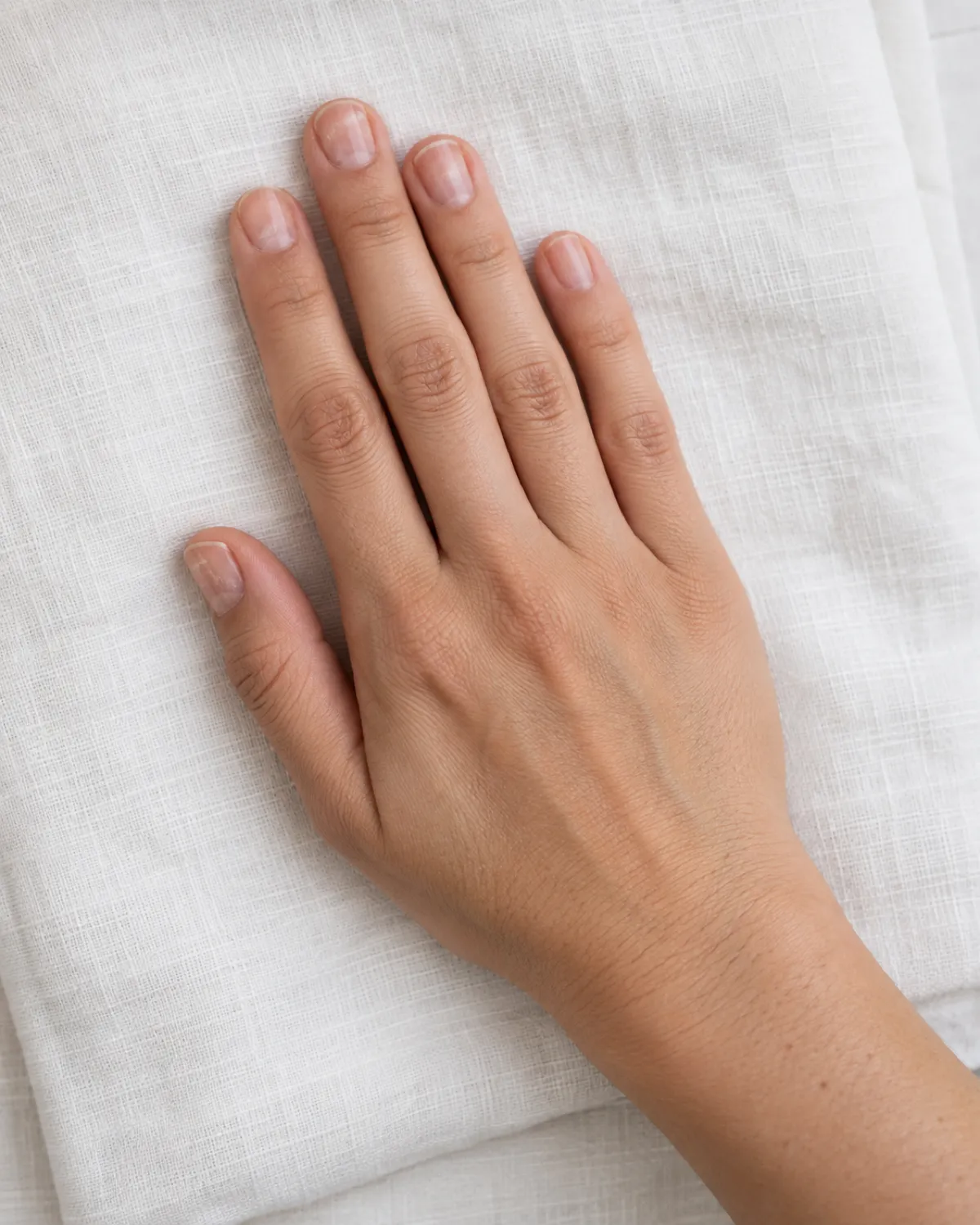 Hand lying flat on white linen with short bare nails showing faint white patches and rough matte texture from acrylic damage