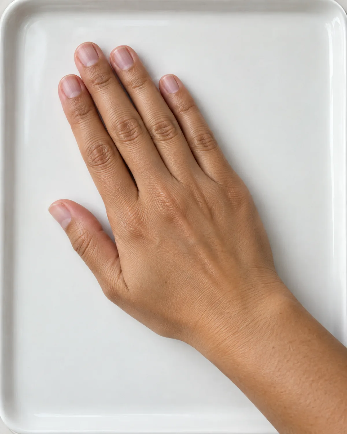 Hand with short natural nails showing subtle vertical ridging on the nail plates, resting on a white porcelain tray